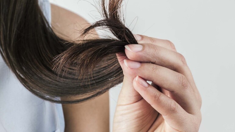 ¿Caída del cabello?